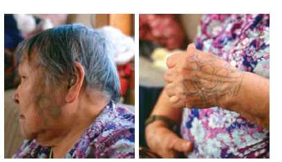 How Much Is Tattoo Removal How Much Is Tattoo Removal