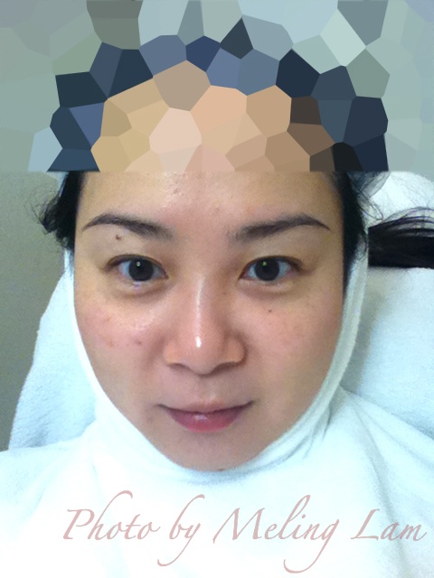 reenex cps 水基酸更新療程