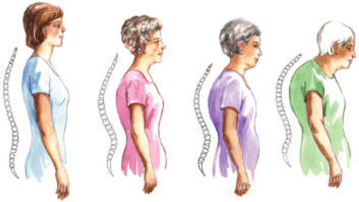 Spine Posture