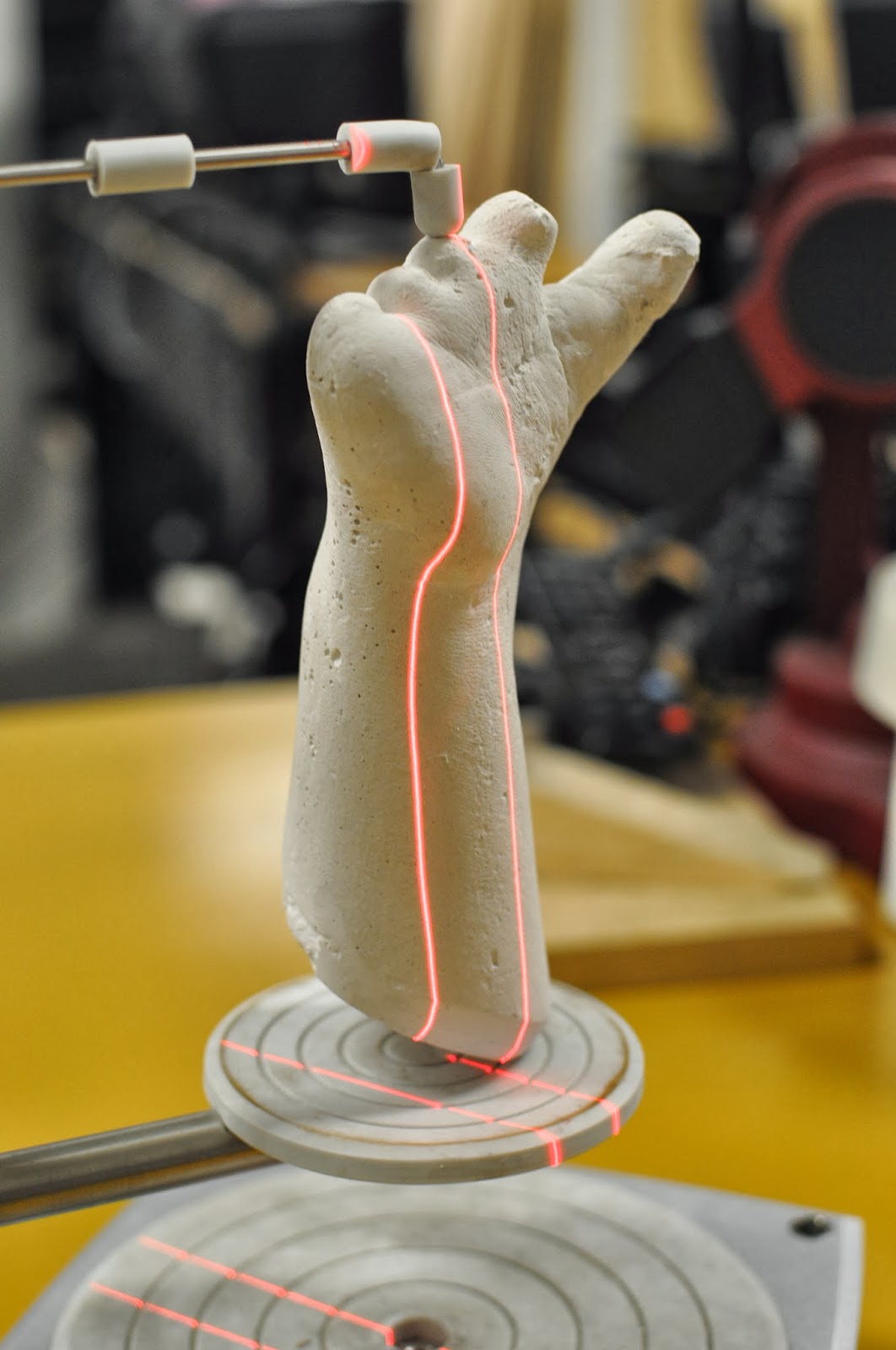 handverker shea's plaster cast scan