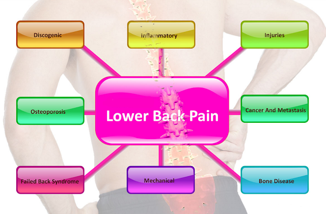 Causes and Symptoms of Back Pain