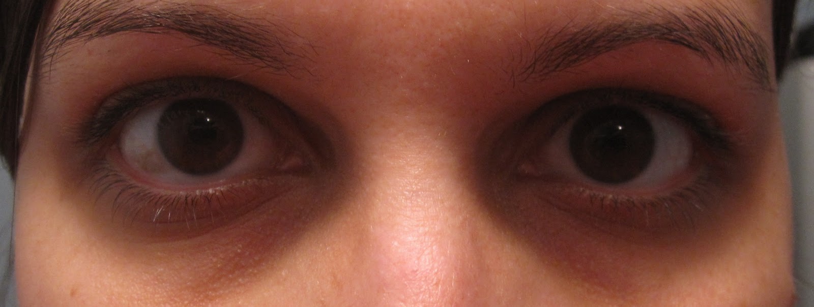 disconnected thoughts Slavic "eye pockets"?