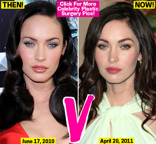 Trendystyle Megan Fox In 2012 Plastic Surgery Video On Youtube