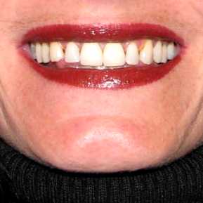 Kim S Korner I Took The Crest And Oral B 3d White Challenge Pretty Sure I Got A B