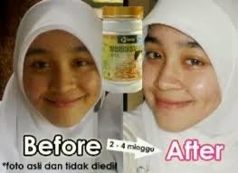 Bukti dan Testimoni Emilay whitening Bukti dan Testimoni Emilay whitening