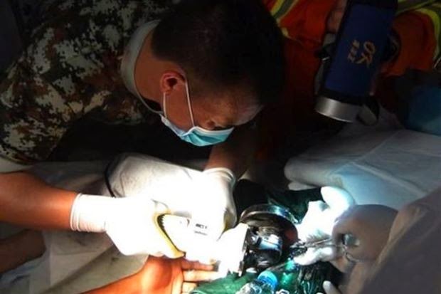 Kemaluan Lelaki Tersangkut Pada Batang Paip Selama 2 Hari item-thumbnail