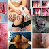 Obat Wasir (Hemoroid) Untuk Pegawai Kantor thumbnail
