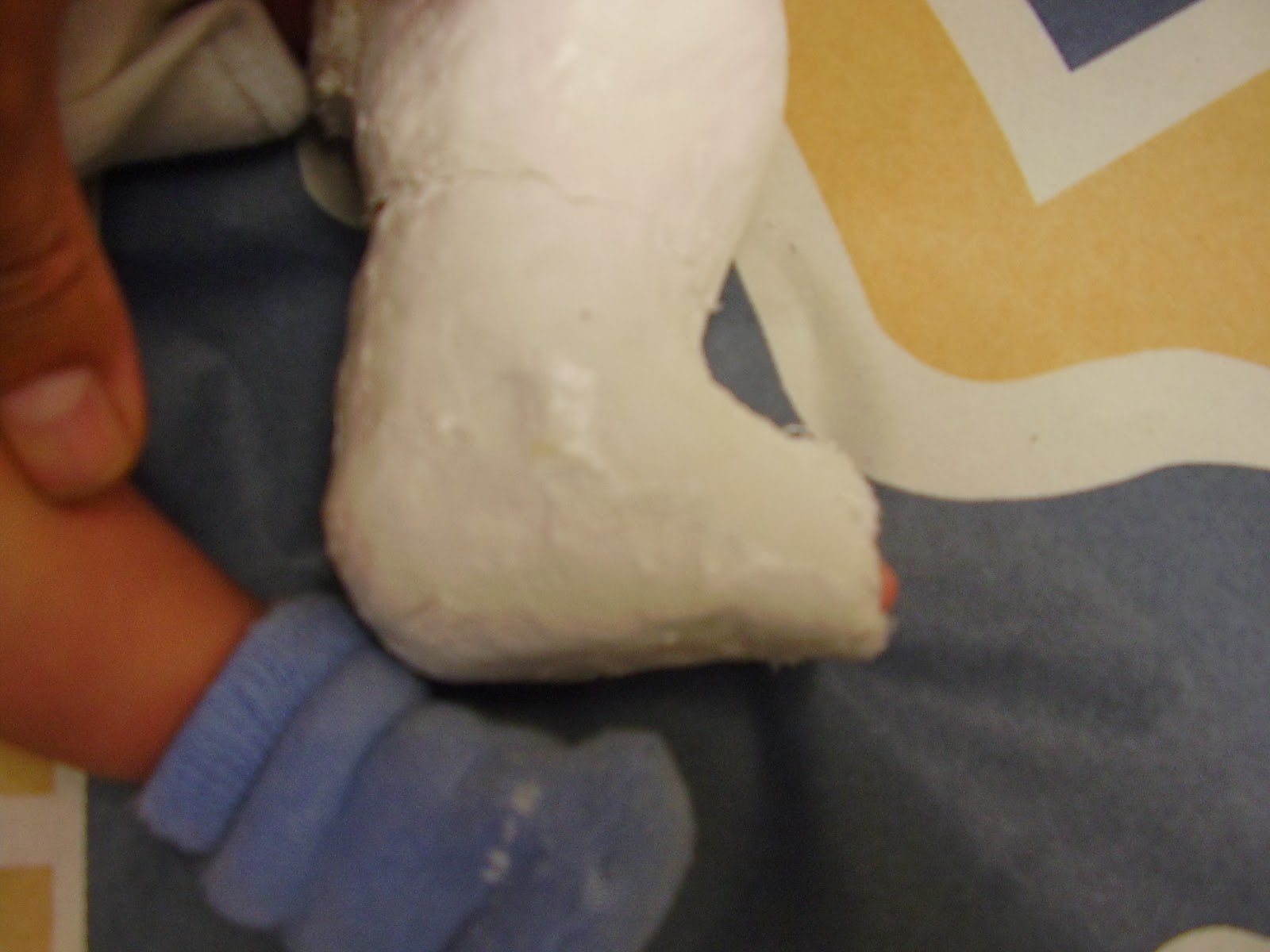 ortopediatrica PIE EQUINO VARO CONGÉNITO