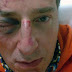 Roma: attivista gay aggredito a sassate