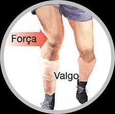 Problemas No Joelho Ligamentos Problemas No Joelho Ligamentos