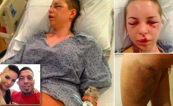 Pics: porn star reveals injuries she suffered after horrific ...
