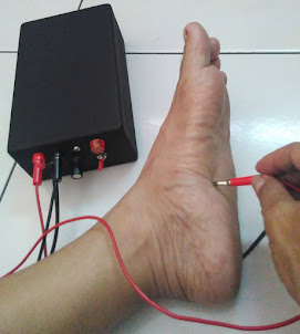 terapi titik meridian telapak kaki