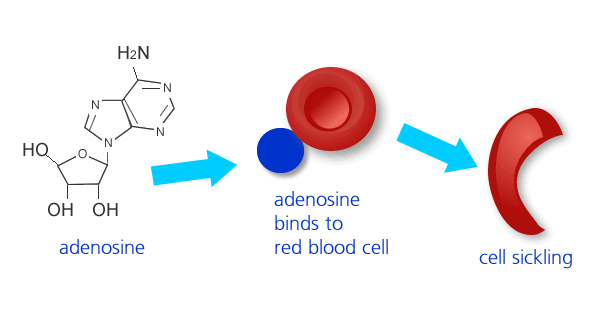sickle cell disease research paper sickle cell disease research paper