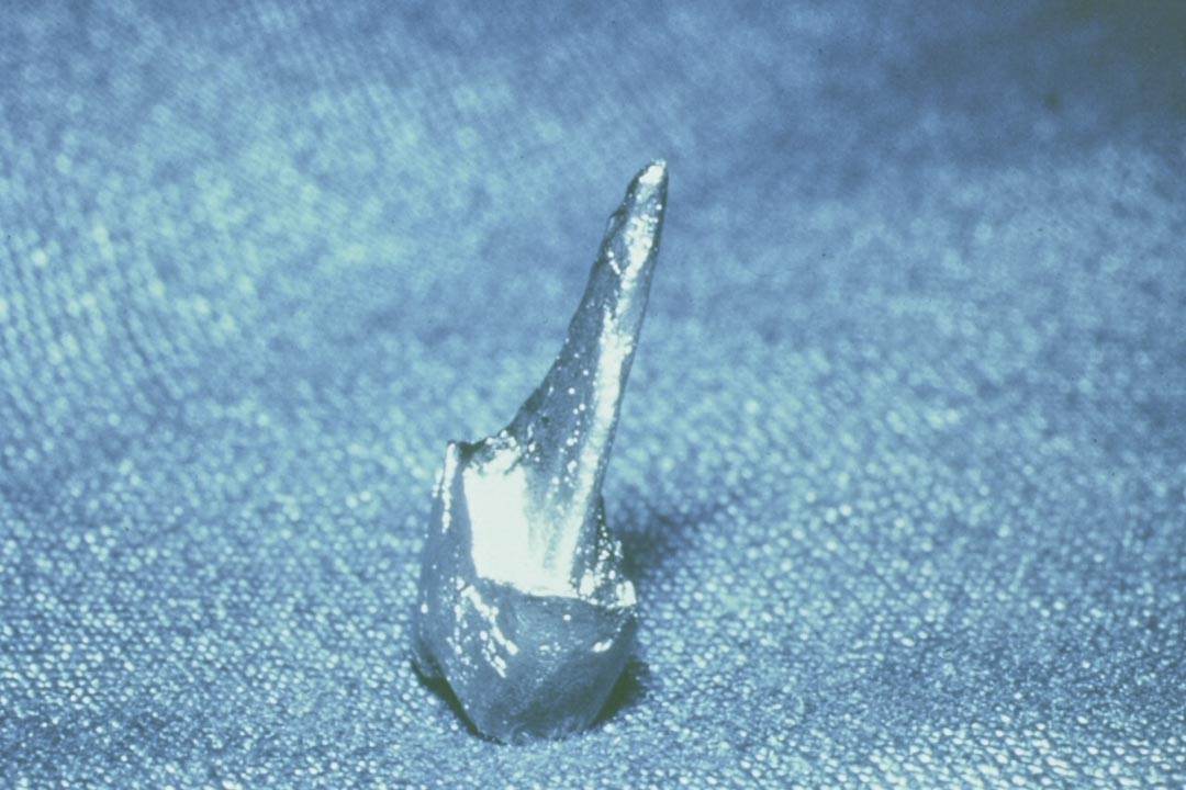 Dentistry Custom Cast Dowel Core