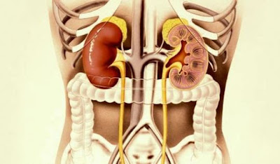 Obat Tradisional Gagal Ginjal ~ Obat Herbal Jantung Koroner