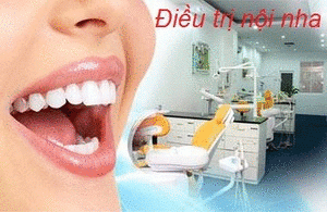 Điều trị nội nha