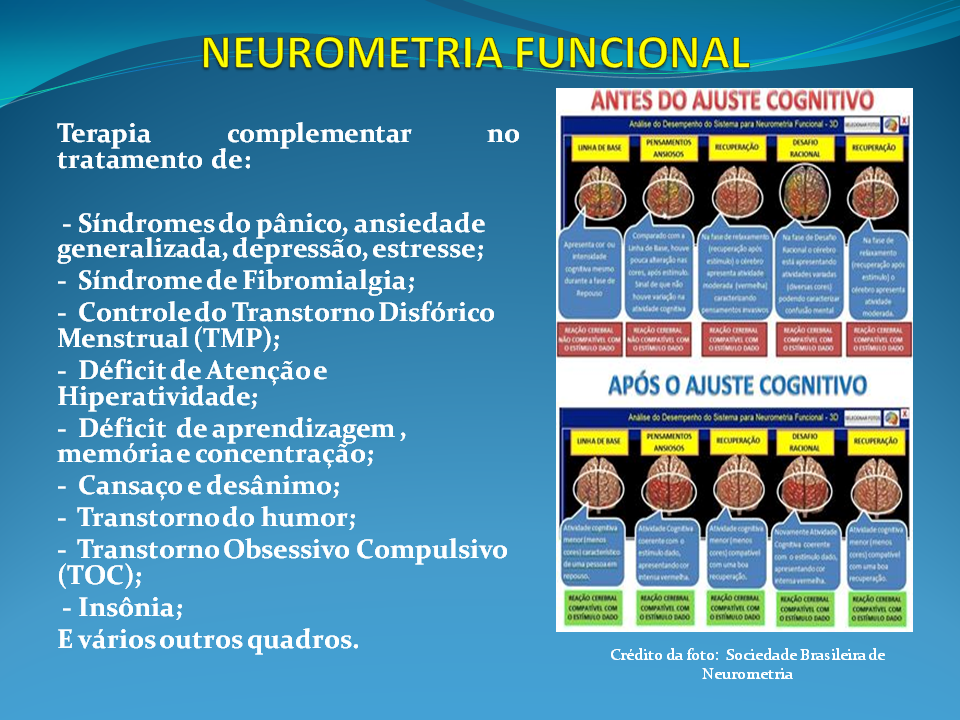 Neurometria Multifuncional