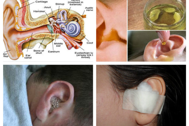 How to Cure Labyrinthitis advise How to Cure Labyrinthitis forecasting