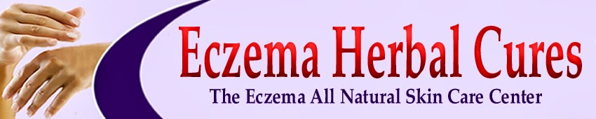 Eczema Herbal Cures