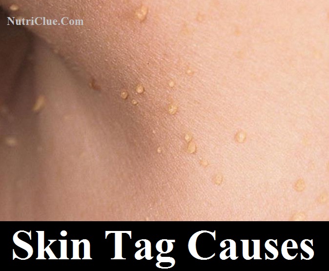 Natural Skin Repair Remedies Natural Skin Repair Remedies