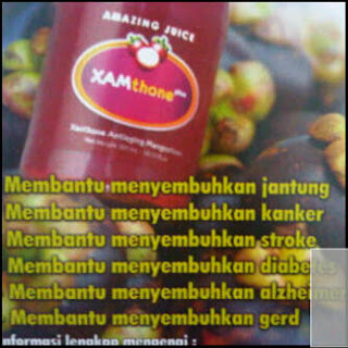 Obat Sakit Kepala Obat Sakit Kepala Menahun