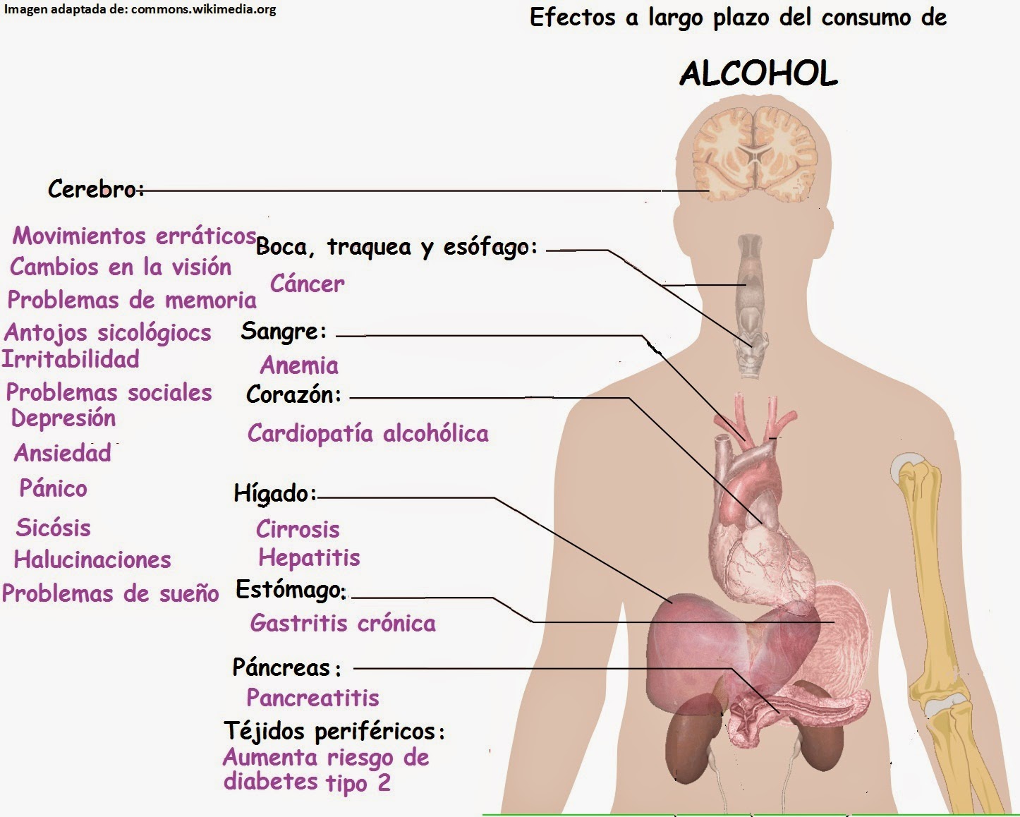 Que curar el alcoholismo las revocaciones de las narcoguaridas