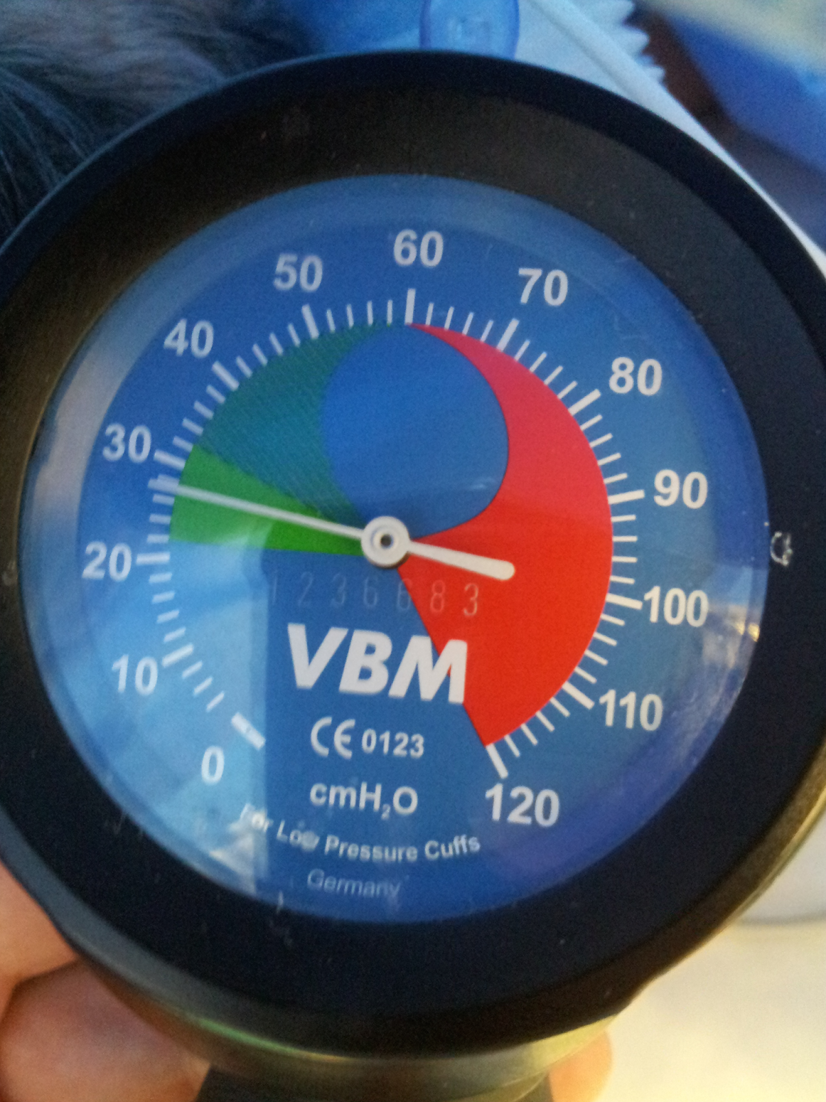 Loveurtrachea, a CRNA Blog