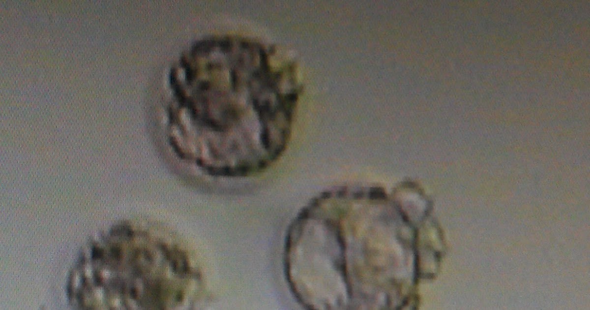 Life and Love in the Petri Dish watch Mo and Will's baby grow!!