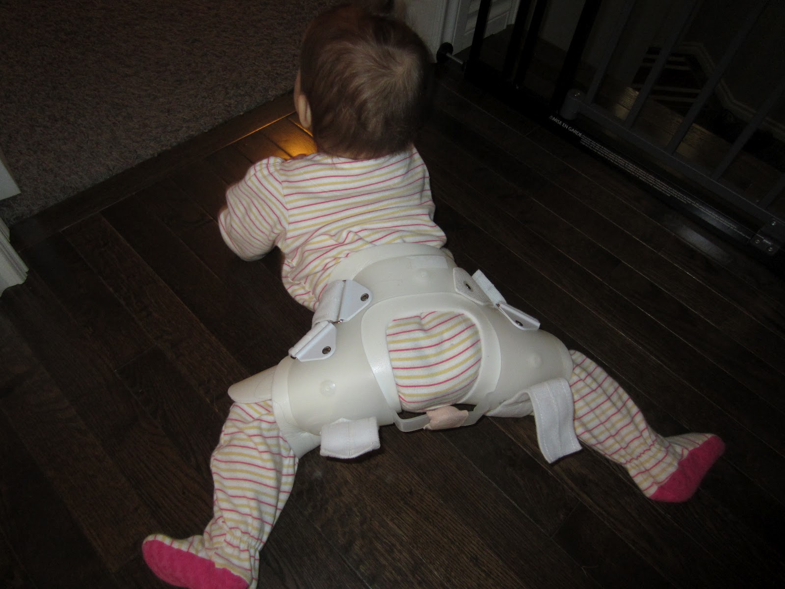 Hip Dysplasia Infant Brace Get More Anythink's