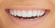 Pearly white teeth