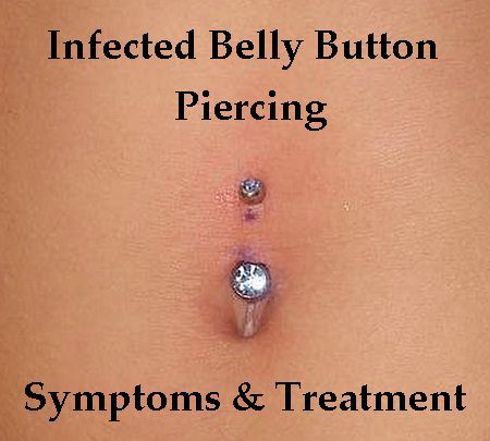 Taking Care Of Infected Belly Button Ring Taking Care Of Infected Belly Button Ring