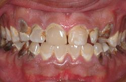 Calgary Orthodontist