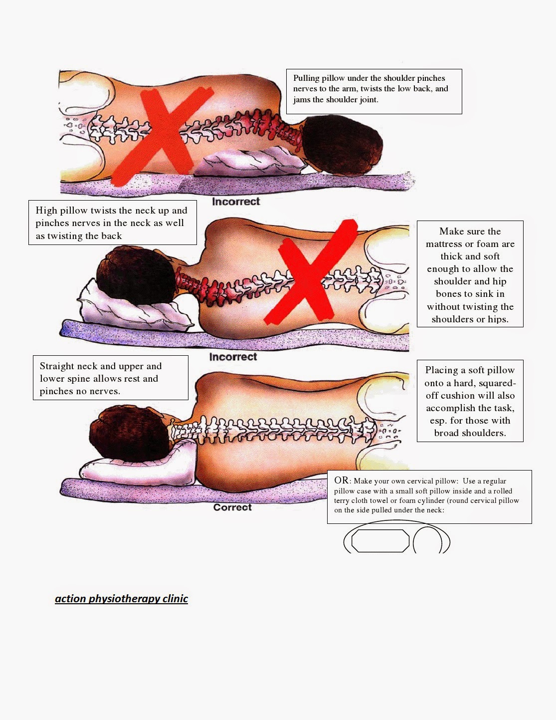 best pillow for back sleepers with apnea bad back mattress 14 images care forever depot best pillow for back sleepers with apnea bad back mattress 14 images care forever depot