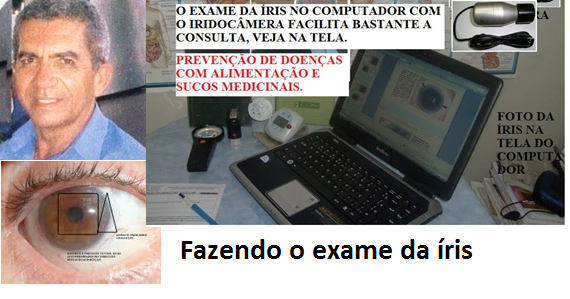 Exame hormonal