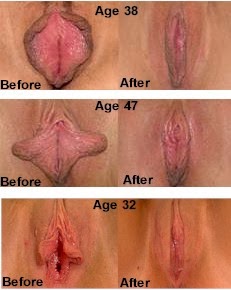 Sex change naked pic