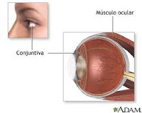 remedios-caseros-para-conjuntivitis