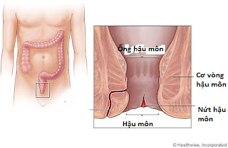 BỆNH NỨT KẼ HẬU MÔN Benh nut ke hau mon