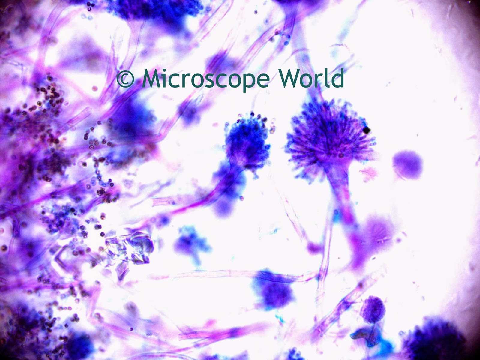 mold under the microscope at 400x