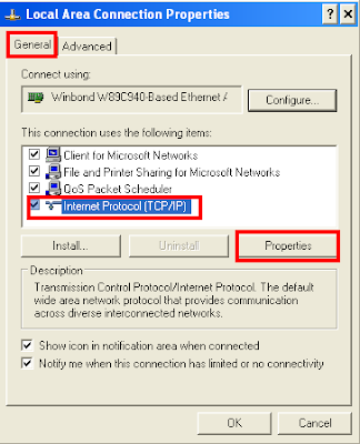 Local Area Network Connection Properties