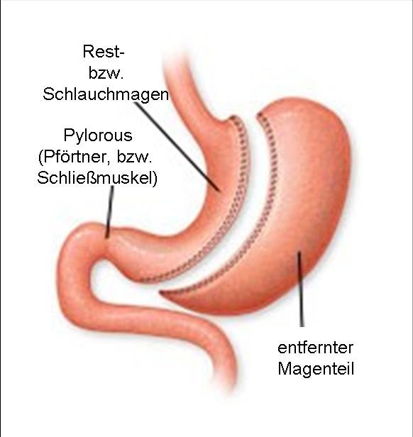 Mein Abstieg April 2012