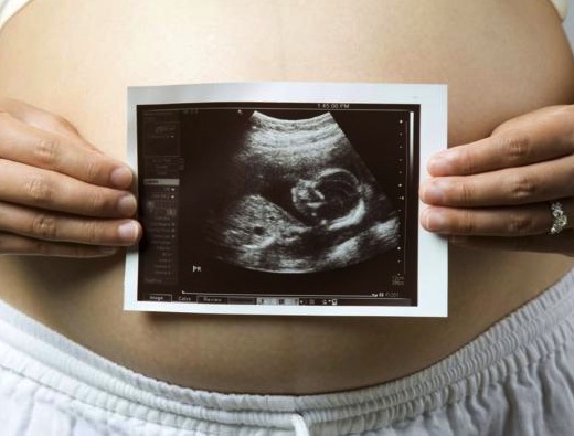 DIAGNOSTICO PRENATAL diagnostico prenatal: