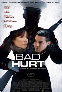Bad Hurt