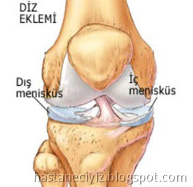 menisküs nedir, menüsküs ne demek