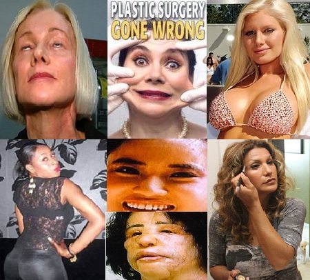 Worst Plastic Surgery Face on Worst Plastic Surgery Disasters