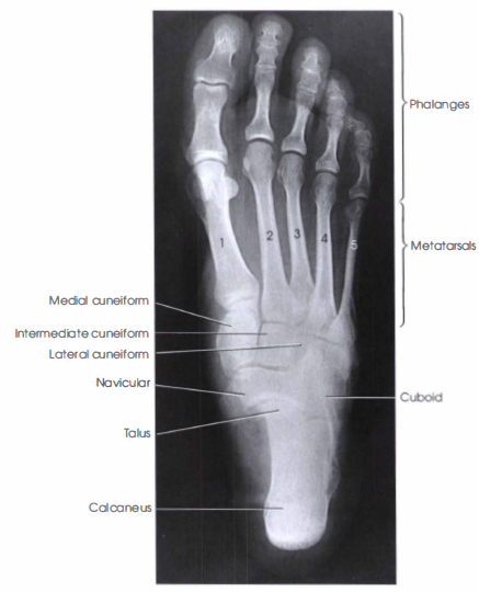 Ap Weight Bearing Projection Foot Radtechonduty