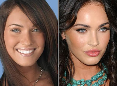 megan fox plastic surgery before and after