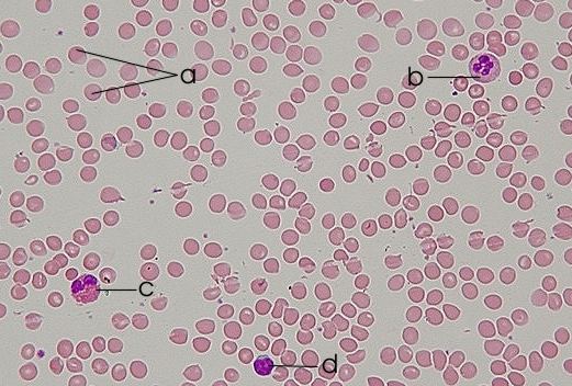 Blood Smear Labeled