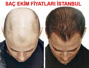 Sac Ekim Merkezi Sac Ekim Fiyatlari Istanbul