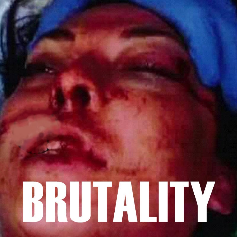 POLICE BRUTALITY: Battered and Beaten Suspect