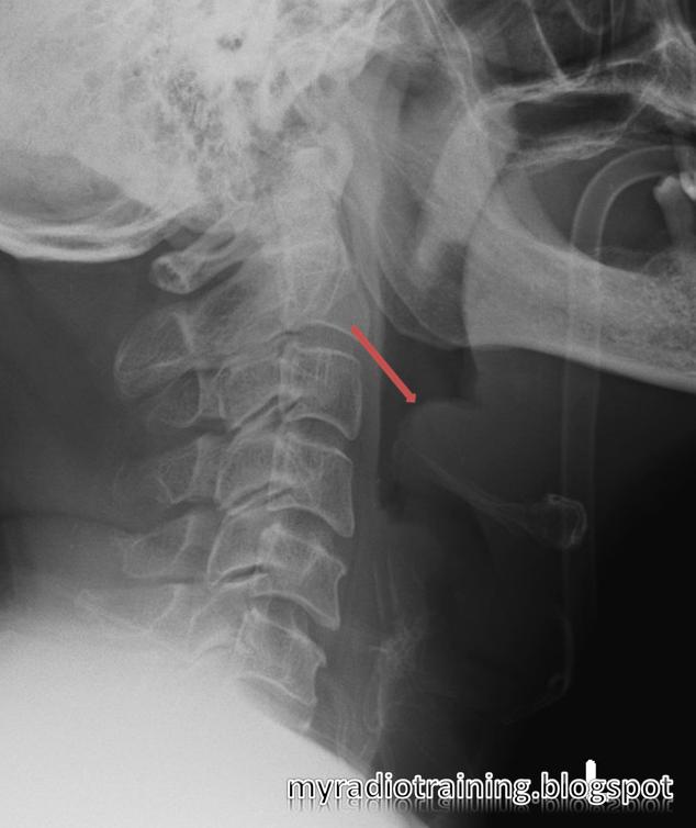 My Radiology Training Diary: February 2011